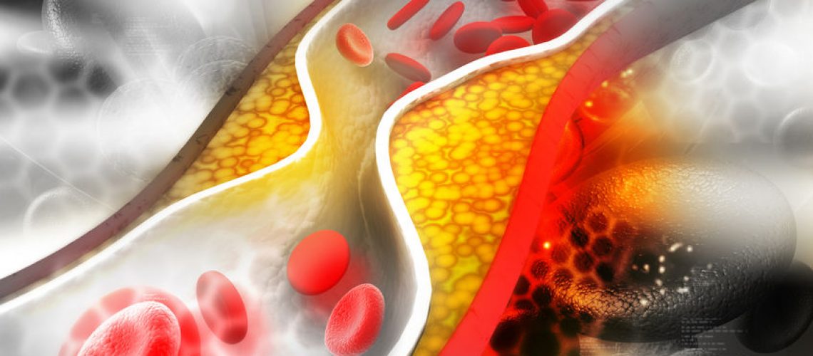 doenças cardiovasculares